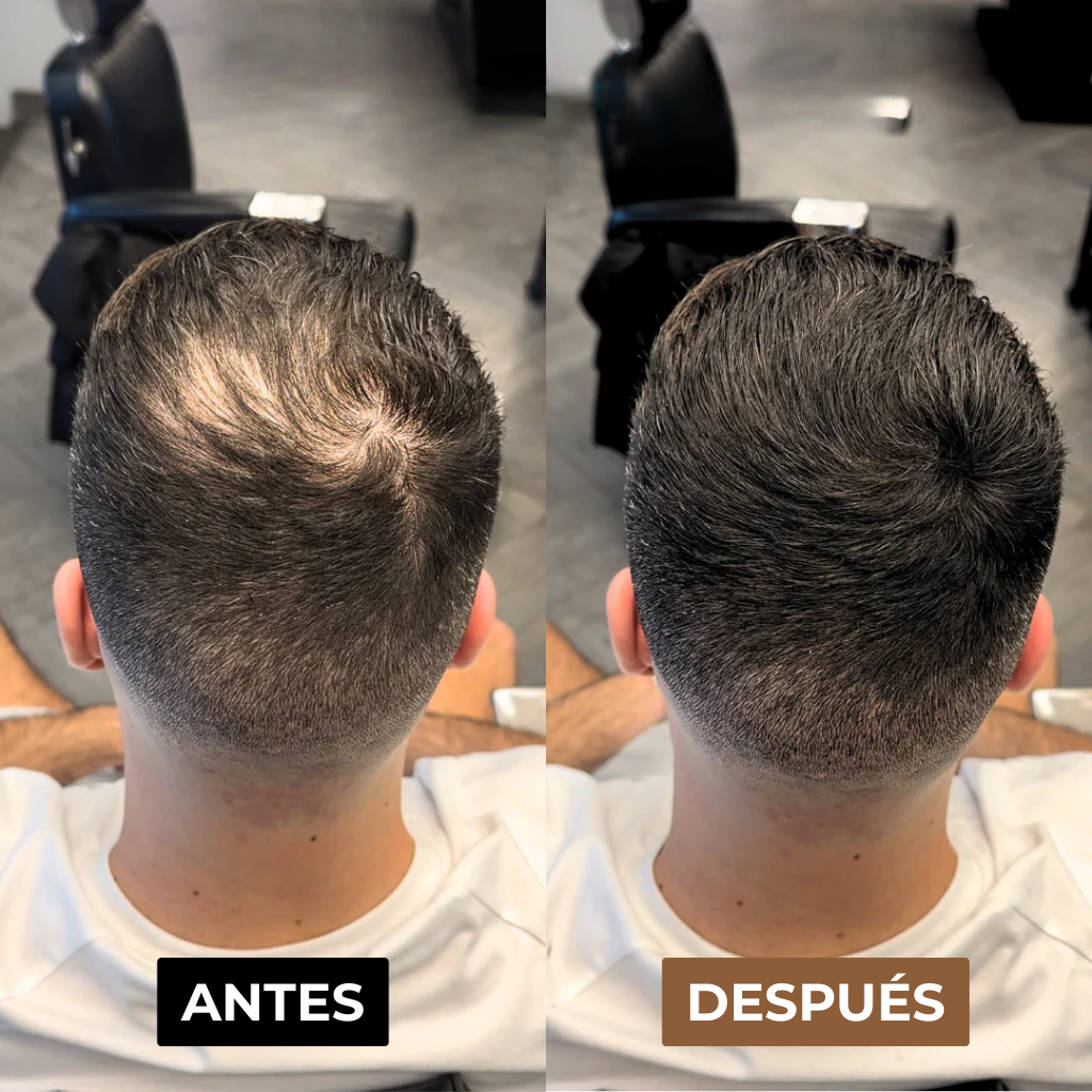 Camuflaje Capilar Solvera™