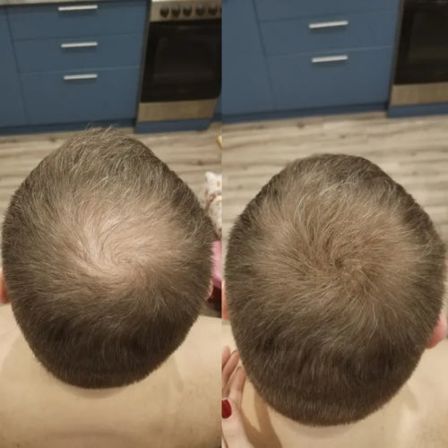 N.º1 en Camuflaje Capilar